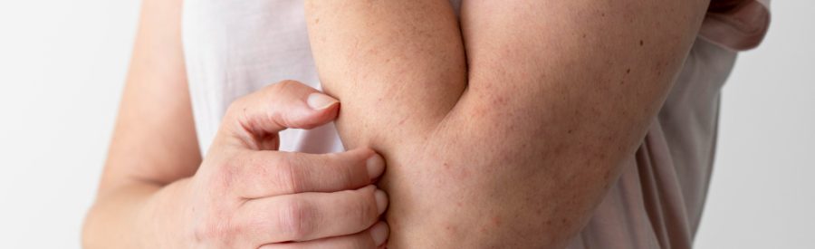 Miopatia inflamatória